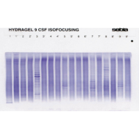 Prążki oligoklonalne