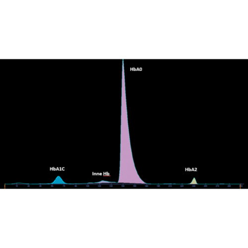 Elektroforeza kapilarna Hemoglobina glikowana – HbA1C