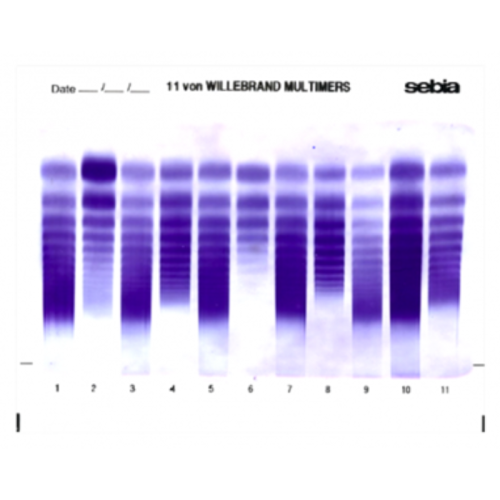 Multimery czynnika von Willebranda (VWF)