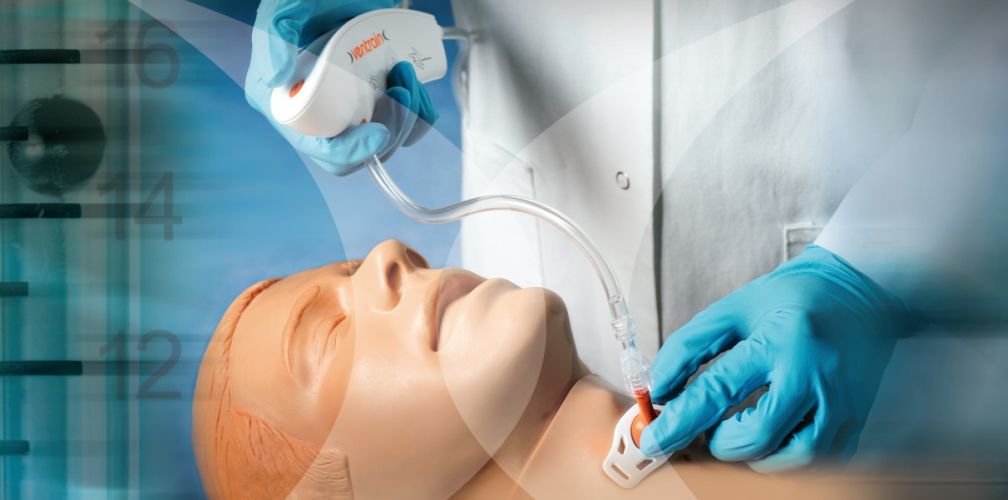 Ventrain – Przyrząd do wentylacji poprzez konikopunkcję