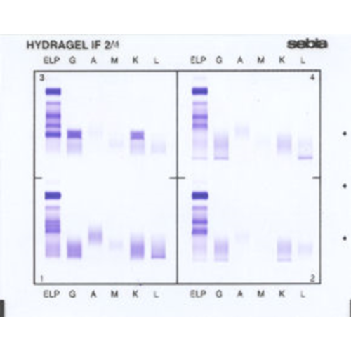 Immunofiksacja białek surowicy (IFE)