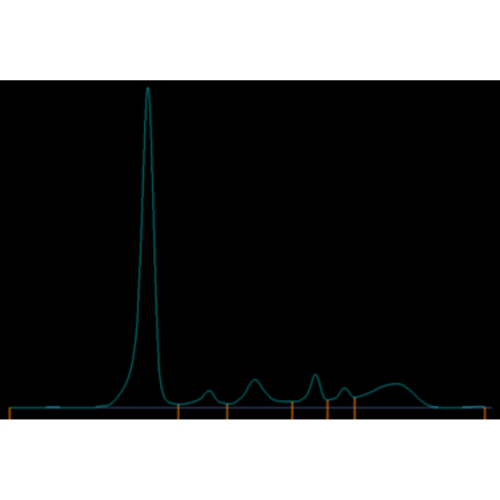 Elektroforeza białek surowicy i moczu (SPE, UPE)
